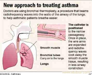 過敏性支氣管炎哮喘最新藥物研究進(jìn)展